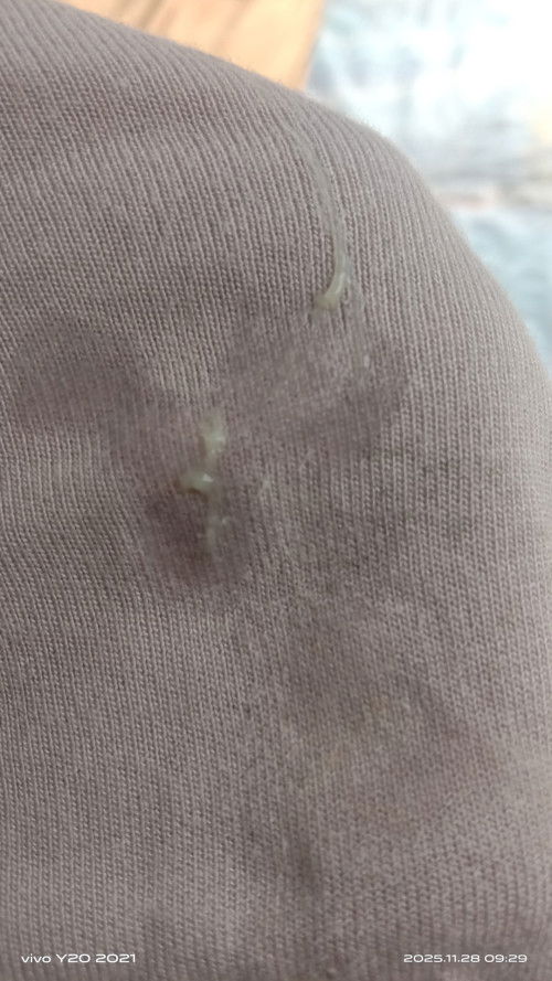 Keputihan saat hamil