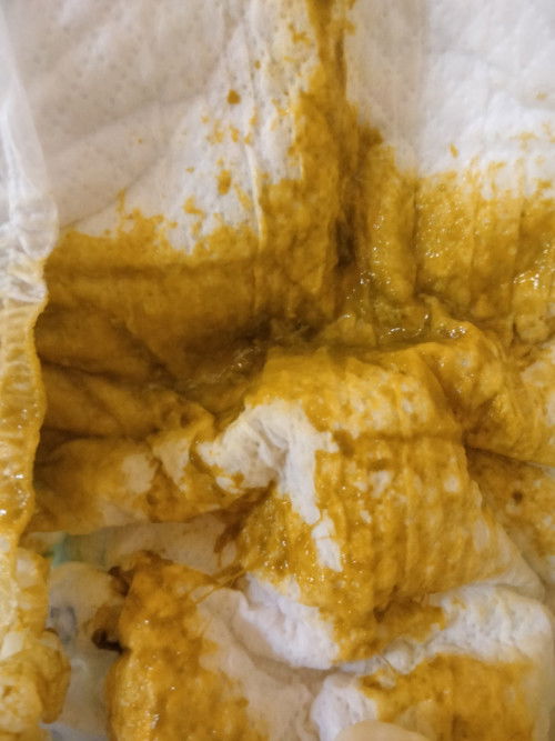 Bab seperti ini normal tidak