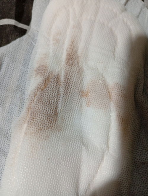 Ano Kaya Ito guys, humihilab na dn tyan ko pero d ganun kasakit