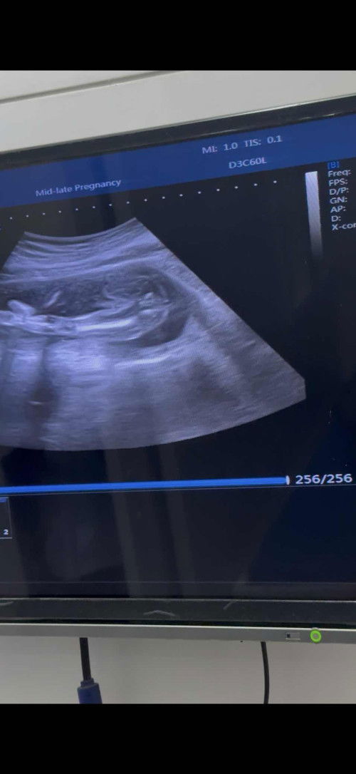 ควาทยาวของขา