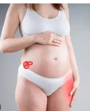 Hello mga mommy's may nakakaranas po sa Inyo Neto sumasakit kaliwang tagiliran ko 26 weeks napo ako