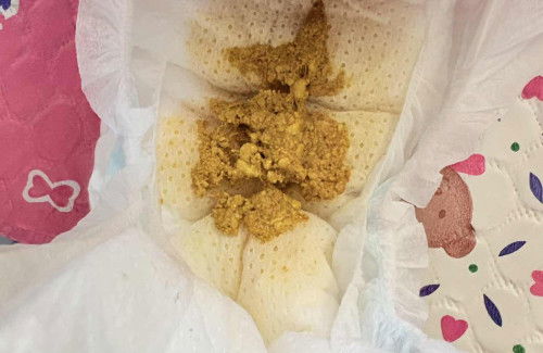 น้องกินนมชงอึแบบนี้ปกติมั้ยคะแม่ๆ