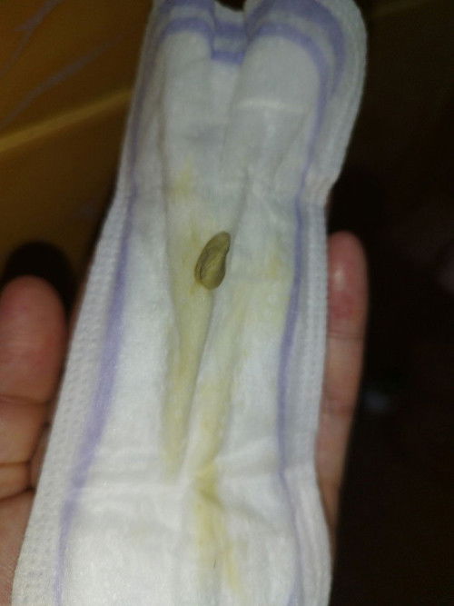 Results tak +ve, tak -ve