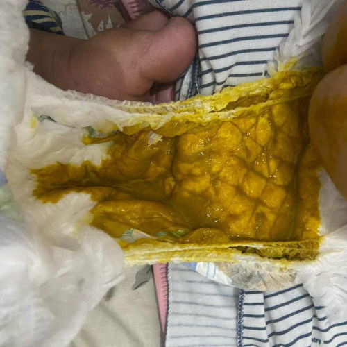 Pup bayi 3 bulan encer