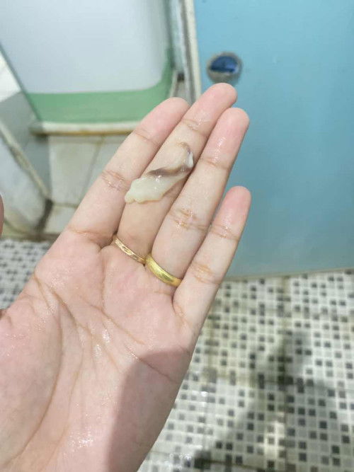 Keluar lendir ada kecoklatannya