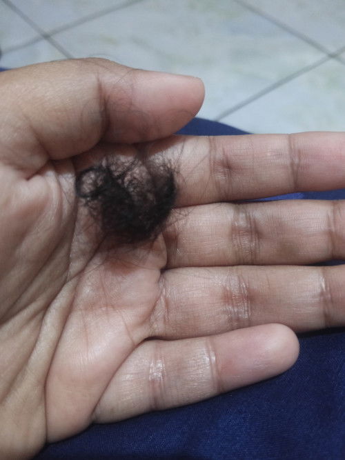 Trimester 3 rambut rontok parah