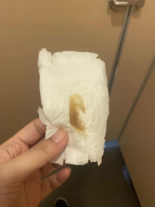 สอบถามแม่ๆทุกท่านค่ะ