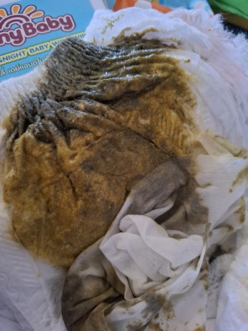 อึน้องเป็นสีเขียวขี้ม้าแบบนี้ปกติไหมค่ะกินนมผงกับนมแม่ค่ะน้องได้8เดือนแล้วค่ะ