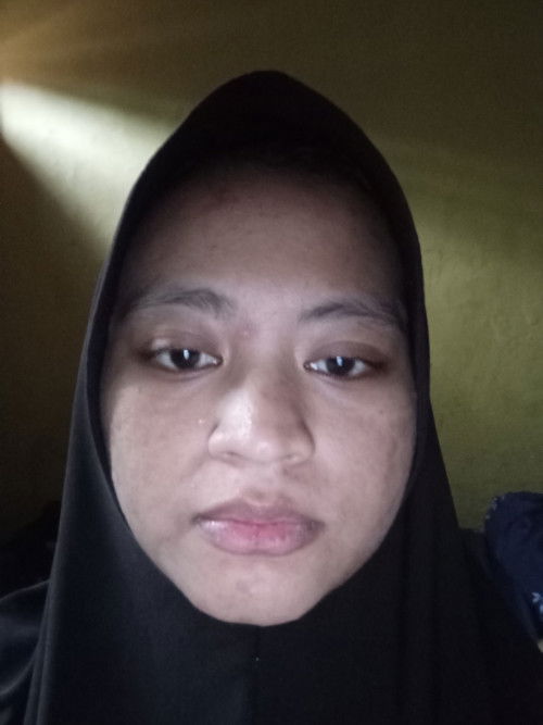 Tips menghilangkan  jerawat ketika hamil