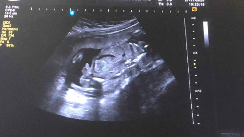 ช่วยวิเคราห์หน่อยค่ะ