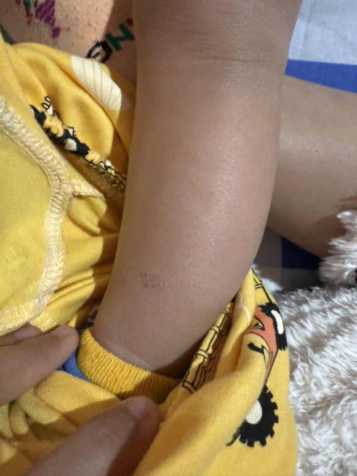 น้องแพ้อะไรไม่รู้ไปหาหมอหมอบอกว่าอาจจะแพ้นมหรือไม่ก็อากาศ