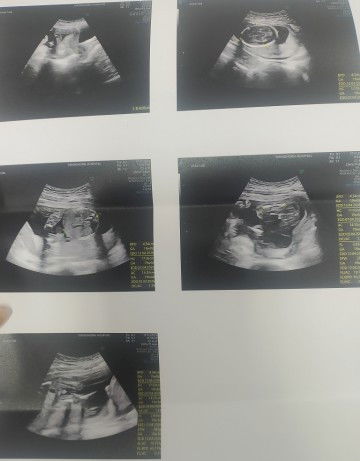 อบากทราบว่าภาพไหนคือหน้าตาของทารกคะ  (ใครมองออกช่วยบอกหน่อยนะคะว่าภาพไหน)