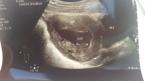 Belum ada detak jantung