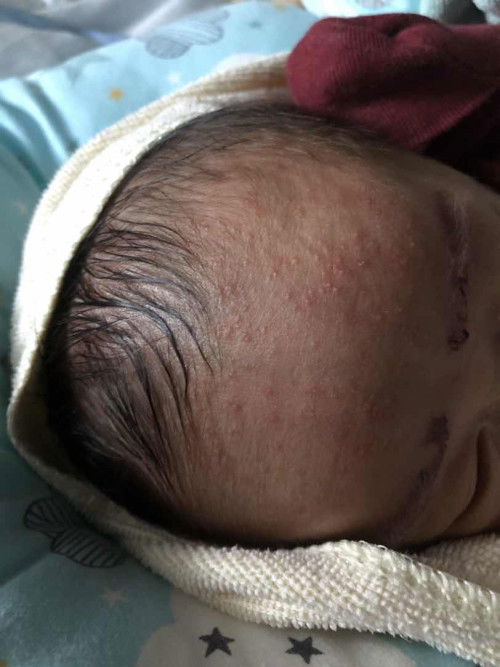 ถามเเม่ๆๆหน่อยคะอันนี้เค้าเรียกอะไรคะไครรู้วิธีทำให้หายบอกหน่อยคะ#ลูกคนแรก