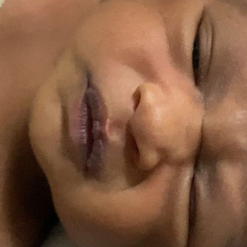 bibir bayi nb menghitam dan kering