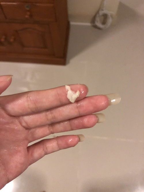 ท้องเข้าเดือนที่7แลเวมีตกขาวสีแบบนี้ปกติมั้ยค่ะ🥹 ล่ะมันเยอะมาก