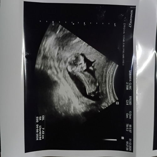 ทีมมิถุนายน69