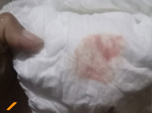 ถ้าตรวจครรภ์ขึ้น2ขีดทั้ง2อันแล้วมีเลือดออกทางช่องคลอดคืออะไรค่ะ