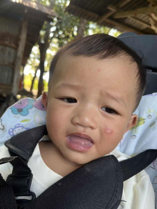 มีแม่ๆบ้านไหนลูกเคยเป็นมั๊ยคะ