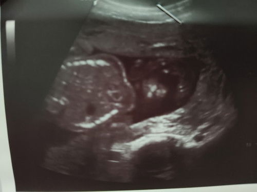 ขอสอบถามค่ะ