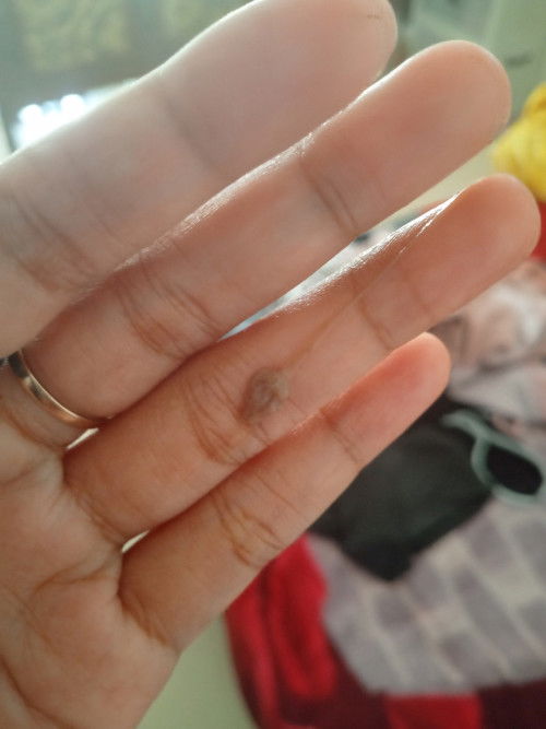 Apakah ini dinamakan flek kehamilan bukan ya