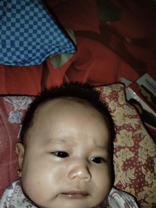 Bintik putih di wajah