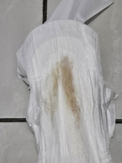 hamil 10 minggu keluar seperti ini, ada yang pernah mengalami juga bun?