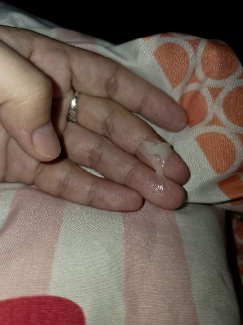 อายุครรภ์ 35+1 มีมูกขาวแบบนี้ ต้องลาพักผ่อนเลยไหมคะ ท้องแรก