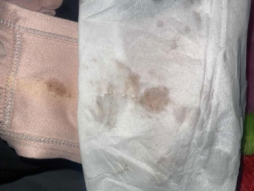 Flek di usia 5 minggu 3 hari