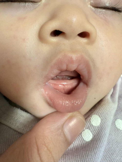 Teething or Something else?