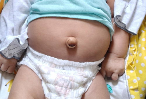 Puser normal atau tidak ??