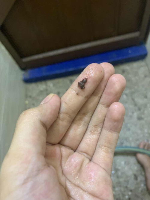 turun tanda coklat 38mggu 4 hari