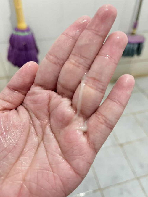 สอบถามค่ะ37+4มีมูกใสแบบนี้ใกล้คลอดยังคะ