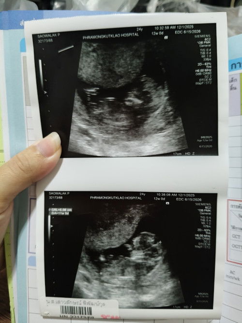 ทีมมิถุนายน69