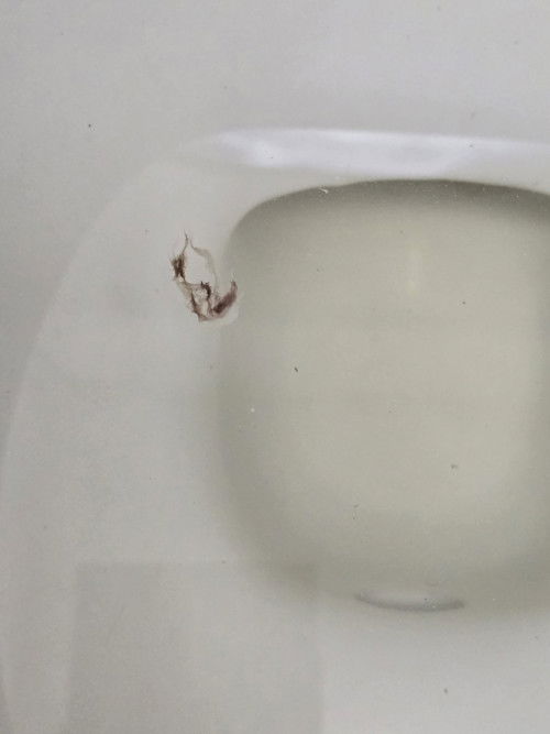 ขอสอบถามแม่ๆค่ะ