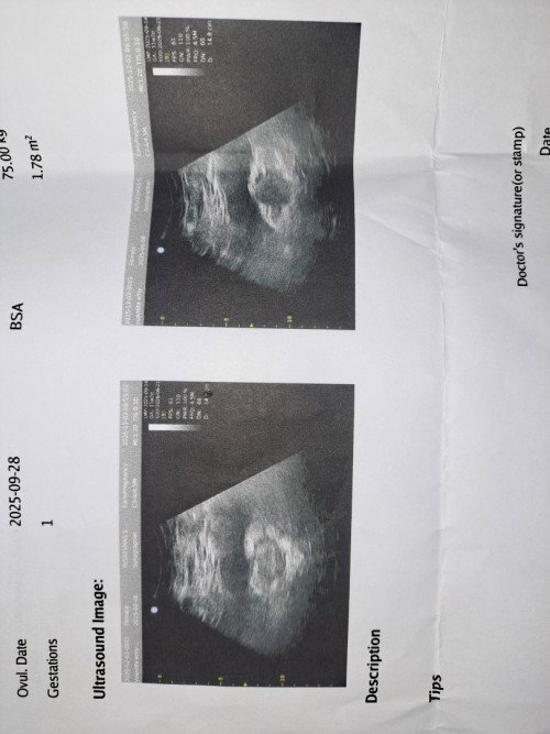 Foto USG 9weeks