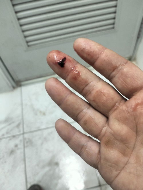 กังวล เพราะมีอาการเลือดออก