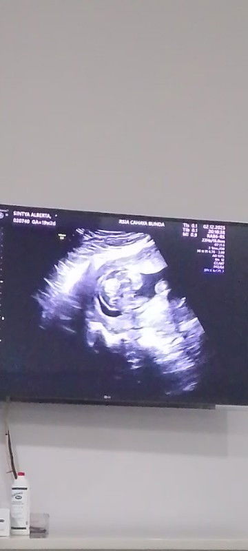 Bun, adakah yang sudah ketahuan jenis kelamin baby nya?
Aku hpl April pertengahan