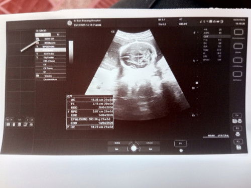 อายุครรภ์