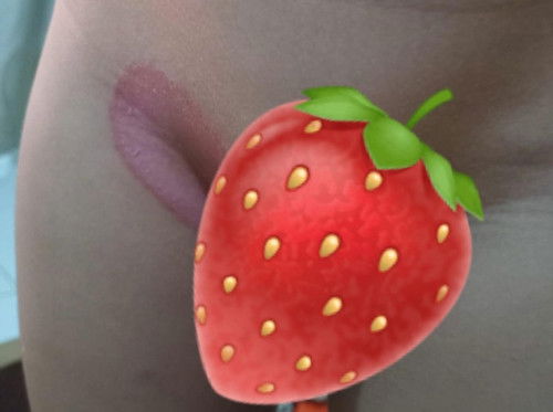 Ruam di area selangkangan