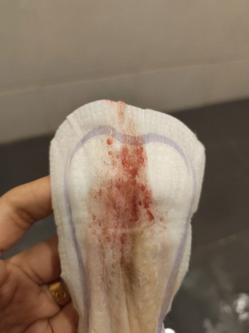 Hi nak tnya sya 28w 4hari