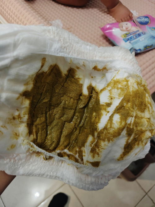 Apakah normal PUP bayi sprti ini?