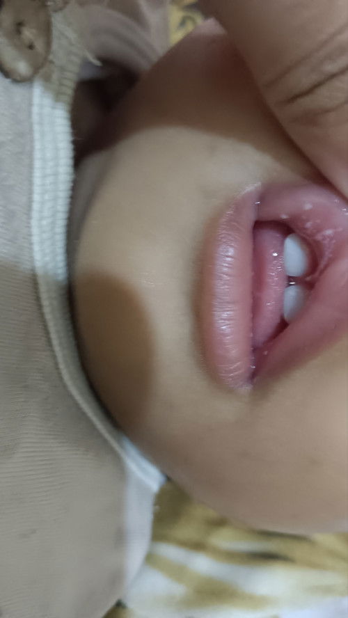 Banyak putih2 dibibir