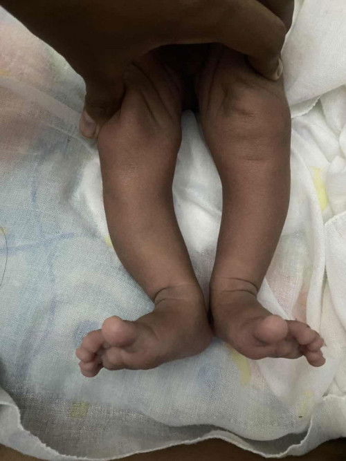 สอบถามแม่ๆหน่อย     แบบนี้ขาลูกจะโก่งมั้ยคะ