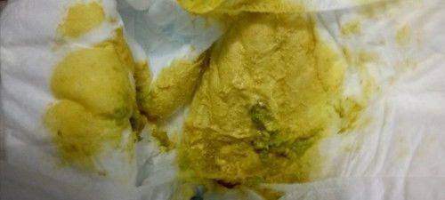 Bun, bab anak saya kaya gini apa normal? Minum sufor
1 atau 2x nenen sama saya tapi ASI saya seret