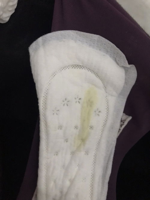 Ni apa ye? Keputihan ke?