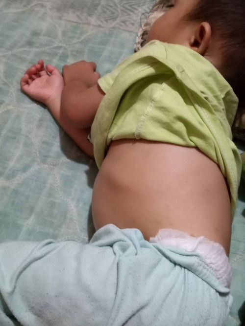 Perut buncit normal ka