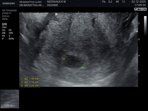 แม่ๆเจอน้องตอนกี่วีคคะ