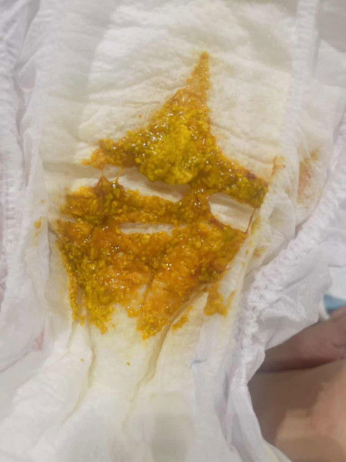 newborn berak berdarah