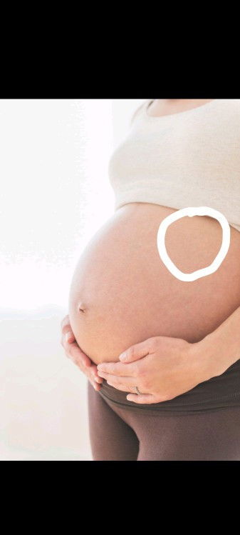 ท้อง32+4 เจ็บตรงนี้มากค่ะ ขยับตัวไม่ได้เลย นั่ง-นอนลำบาก แม่บ้านไหนเป็นบ้างค่ะ แอบกังวัล😓🙏🏻